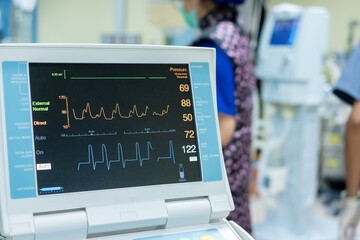 EKG monitor in intra aortic balloon pump machine. Medical equipment.