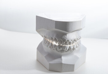 Dental model plaster cast or mould human jaws prothetic on white background