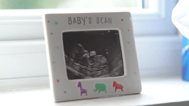 Picture in a picture frame with cute cartoon animals of an ultrasound picture of a baby - Baby Scan