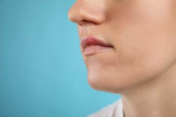 Woman suffering from herpes on light blue background, closeup. Space for text