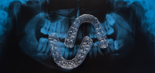 Transparent bite correction trays and x-ray of the jaw. Orthodontist equipment
