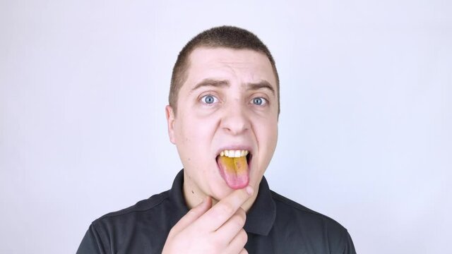 The man has a yellow tongue. Painful yellow coating on the mucous membrane of the tongue. Diseases of the gastrointestinal tract, liver and gallbladder. The consequences of taking antibiotics.
