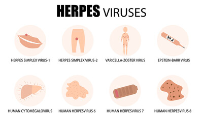 Herpes viruses. Classification, types, and symptoms of human herpes. Medical poster, banner. Vector flat illustration
