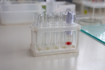 Medical test tubes are on the table. One test tube contains blood.
