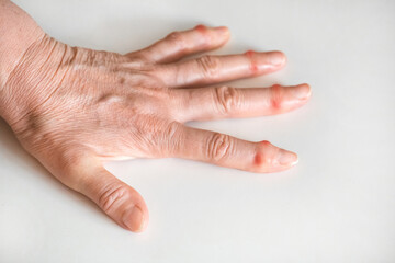 Sick female fingers of an elderly hand on a white background