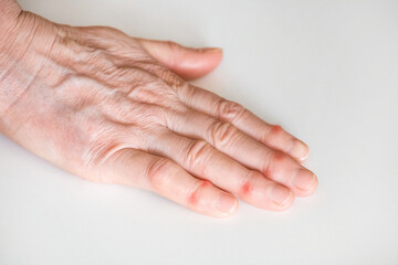 Sick female fingers of an elderly man's hand on a white background