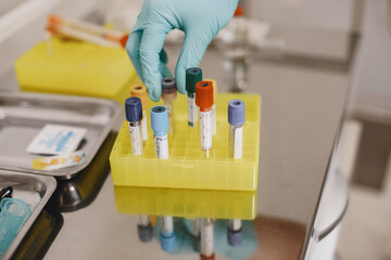 Nurse taking blood sample from patient at the doctors office