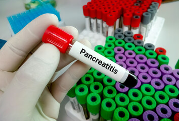 Test tube with blood sample for pancreatitis test, amylase, lipase