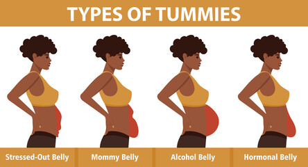 Four types of Tummies for African American women. Overweight woman side view. Problem areas on the stomach. Vector illustration isolated on white background.