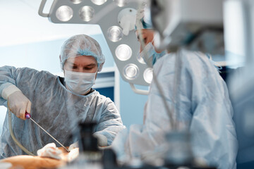 cosmetic liposuction surgery in actual operating room setting showing surgeon hands and cannula.