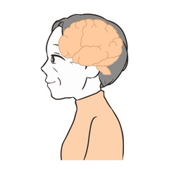 脳の断面図　高齢女性