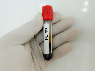 Blood sample for Virus Panel test, diagnosis for viral disease