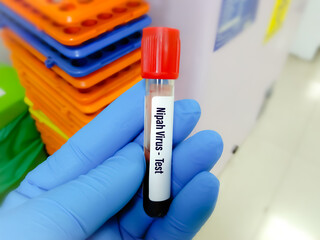 Blood sample for Virus Panel test, diagnosis for viral disease