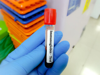 Blood sample tube for Immunoglobulin level test, diagnosis for immunodeficiency disease