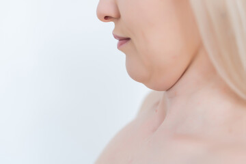 Obraz na płótnie Canvas Closeup of woman's secong chin, problems with excess weight. Woman is touching her chin to demostrate her cosmetic problem. Examining double chin, need facial line correction