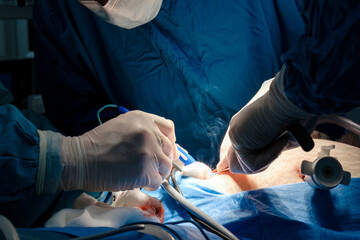 The surgeon holds the electrical coagulator during the operation. Close-up of hands in sterile...