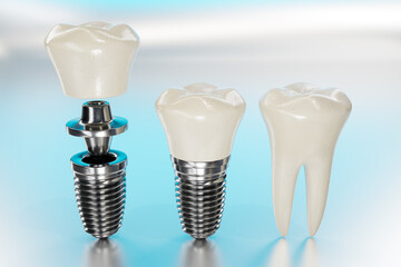 3d realistic rendering set of titanium dental implant on bright blue studio background.
