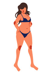 character full body fat woman Underwear standing concept of  Overweight obese cartoon flat lifestyle vector illustration
