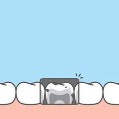 Blank banner lower x-ray unhealthy unhygienic decay teeth illustration vector design on blue background. Dental care concept.