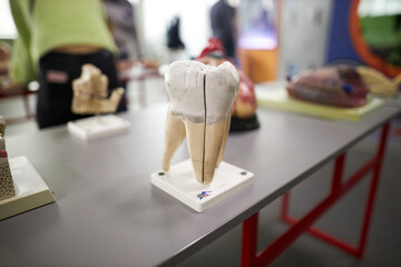 Tooth mock up close-up. Dental mock up teeth close up.