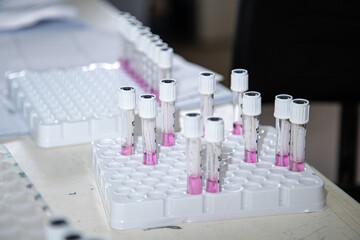 PCR Covid-19 test Lab, Nairob, Kenya