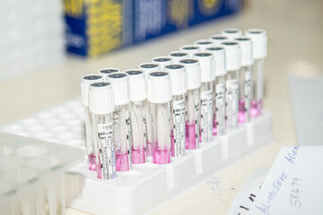 PCR Covid-19 test Lab, Nairob, Kenya