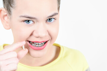 Girl with dental brackets holds pulled tooth. Concept of dentistry and installation of braces.