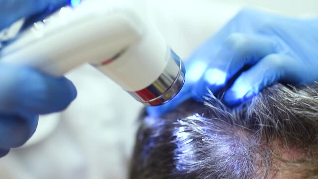 doctor in a modern dermatological clinic makes a diagnosis of the structure and condition of a man's hair