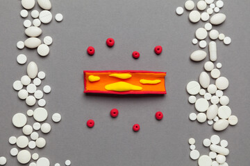 Treatment of atherosclerosis. Model organ lying on a red background with pills.