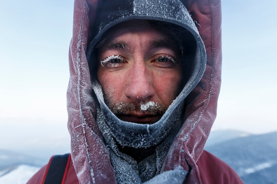 A Frozen Man In A Winter Jacket. Close-up. A Man's Face Covered With Snow And Inium. The Traveler Looks At The Camera.