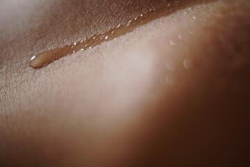Closeup shot of details on sunburnt human skin with dripping sweat - obrazy, fototapety, plakaty