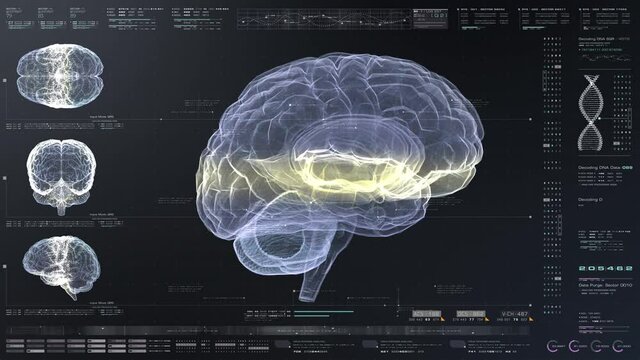 Medical concept : futuristic head up display of virtual holographic brain scan analysis biomedical neuron pathology and diagnostic data for Alzheimer and mental disorder