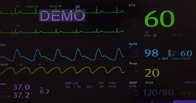 Digital vital signs monitoring with EKG, blood pressure, pulse rate, respiratory rate and oxygen saturation.