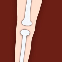 Picture of the leg with bones, in the center of the image is the knee. 