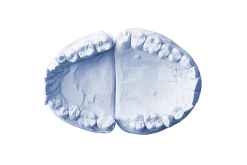 dental impression isolated on white background