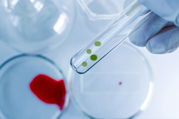Medicine. A gloved hand holds a test tube containing the virus. Elements of a bitmap drawing. The concept of an artificially created virus.