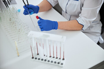 Experienced biochemist in sterile latex gloves conducting a blood test