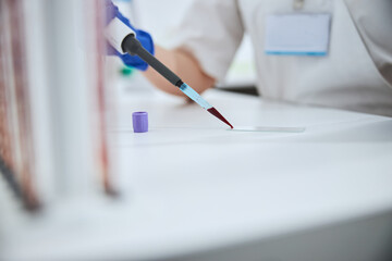 Scientist preparing a specimen for microscopic examination