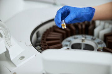 Woman placing a serum vial into an auto chemistry analyzer