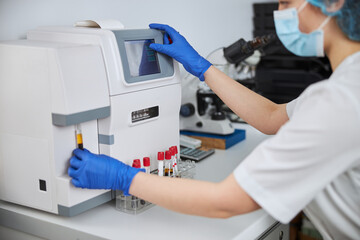 Woman in latex gloves working with a blood cell counter