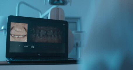 Close-up laptop screen with a human open mouth with teeth and next close picture of human teeth. 