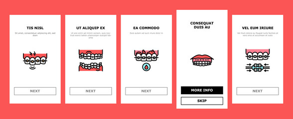 Tooth Braces Accessory Onboarding Mobile App Page Screen Vector. Tooth Braces Installation And Correction, Metal And Sapphire, Ceramic And Plastic Material Illustrations