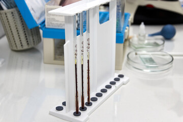 Serological capillary pipettes with blood samples for analysis