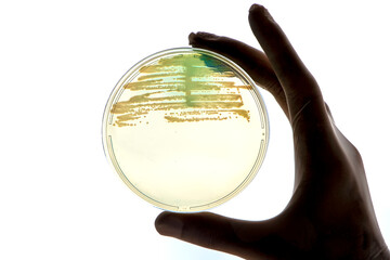 Fototapeta premium Laboratory technician tests for bacterial infection analyzes bacterial colonies growth Lab worker's hand holds test sample in Petri dishes