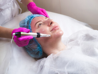 Micro needling therapy. Professional cosmetologist is doing procedure of microneedling. Fractional...