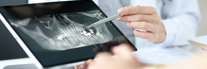 Dentist shows an X-ray of jaw to patient on tablet.