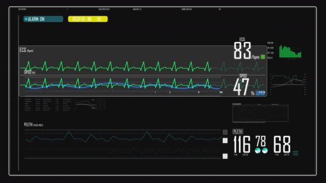 Electrocardiogram ecg background animation for touch display screens with zoom on heart rate. Various medical data and graphs relating to a patients health.