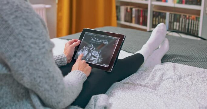 Video of beautiful young pregnant woman looking ultrasound of her baby on digital tablet while lying on bed.