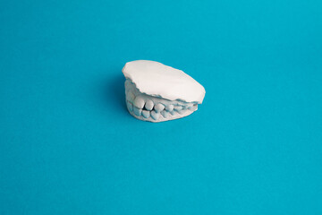 Study model dental impression teeth on blue background © ZaizStudio