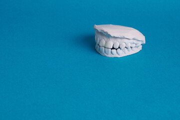 Study model dental impression teeth on blue background © ZaizStudio